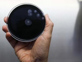 Altri cinque casi di sospetta legionella a Parma, in corso gli accertamenti