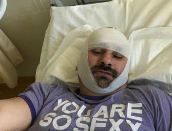 Tassista ex candidato della Lega preso a sprangate a Bologna