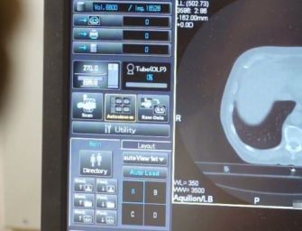 Tecnico radiologo abusò di una paziente durante una visita: denunciato per violenza sessuale