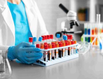 Reggio. Guida sotto stupefacenti, per riavere la patente anche l’analisi dei capelli