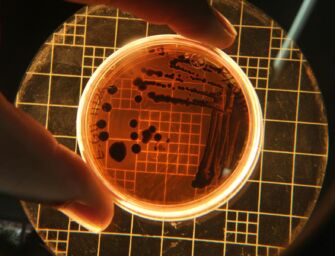 In tre settimane a Reggio 19 positività per salmonella, oltre 50 i casi sospetti